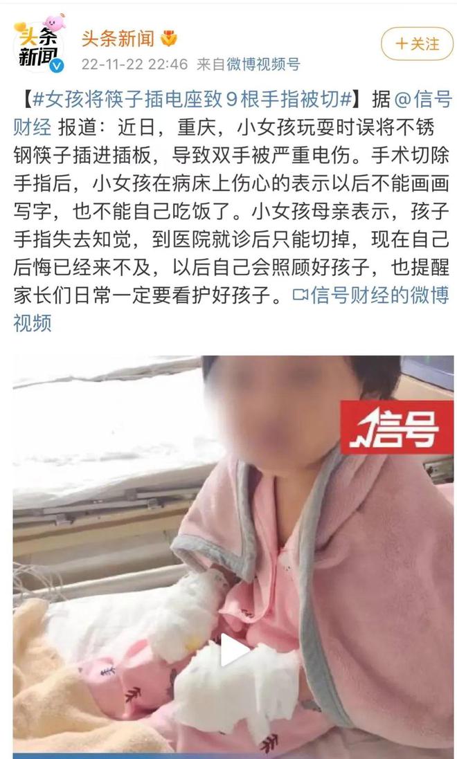 开云 开云体育官网痛心！重庆一女童用不锈钢筷子插入插座双手被严重电伤(图1)
