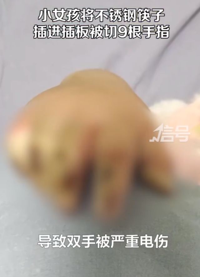 女孩将不锈钢筷子插电座致9根手指被切！幼儿居家用电安全要注意哪些？速戳→开云 开云体育(图1)