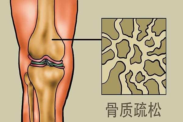 长期喝茶的人会怎样？老年人喝茶牢记“2不喝、3不做”益处多开云 开云体育平台(图1)